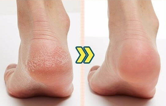 before-after-e1552765026953.jpg